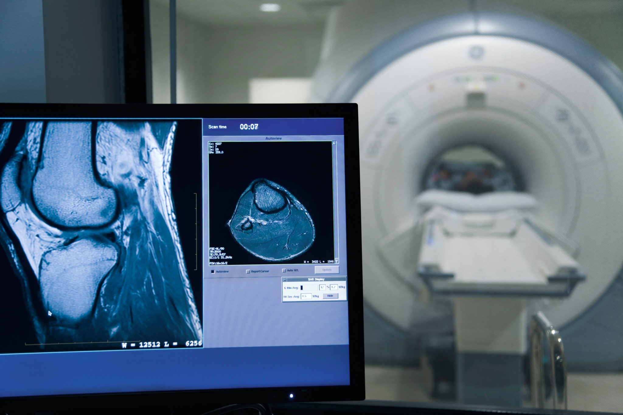 Ein Magnetresonanztomograf ist teuer, deshalb wollen Spitäler solche Diagnosegeräte gut auslasten. Doch: Damit erhöhen sie die Gesundheitskosten.