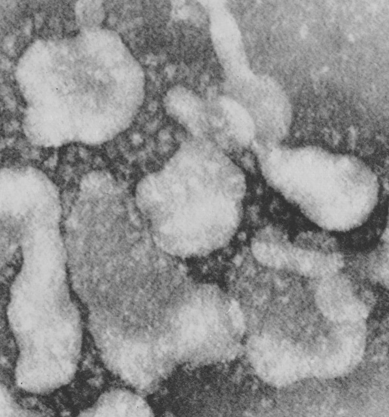 Elektronenmikroskopisches Bild aus den 60er Jahren eines Coronavirus