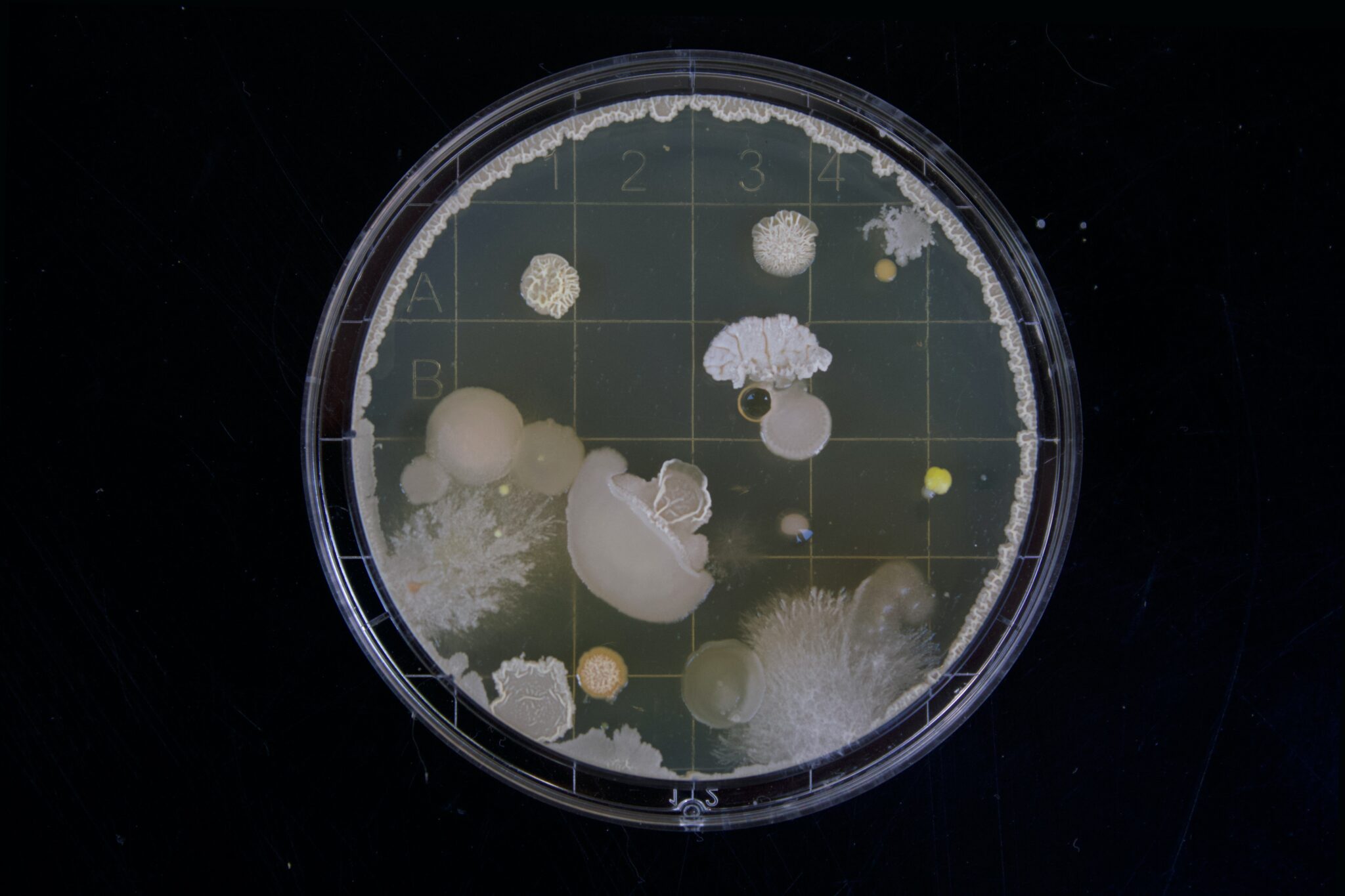 Petrischale mit Erregern, die aussehen wie eine Unterwasserlandschaft mit Quallen.